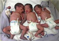 تولد سه قلوها در بیمارستان بی بی حکیمه گچساران