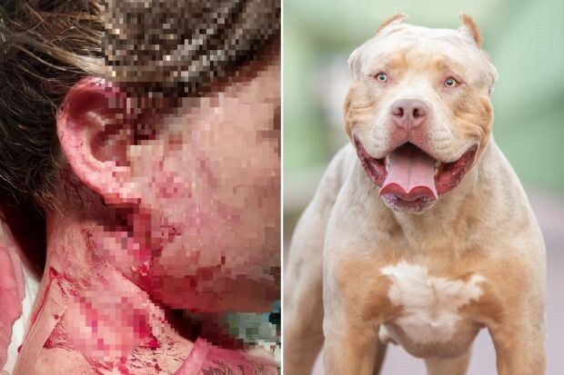 انگلیس؛ افزایش افرادی که قربانی سگ هایشان میشوند انگلیس؛ افزایش افرادی که قربانی سگ هایشان میشوند